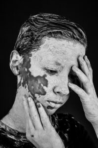 入浴中の色素沈着を予防するためのボディケア方法は？